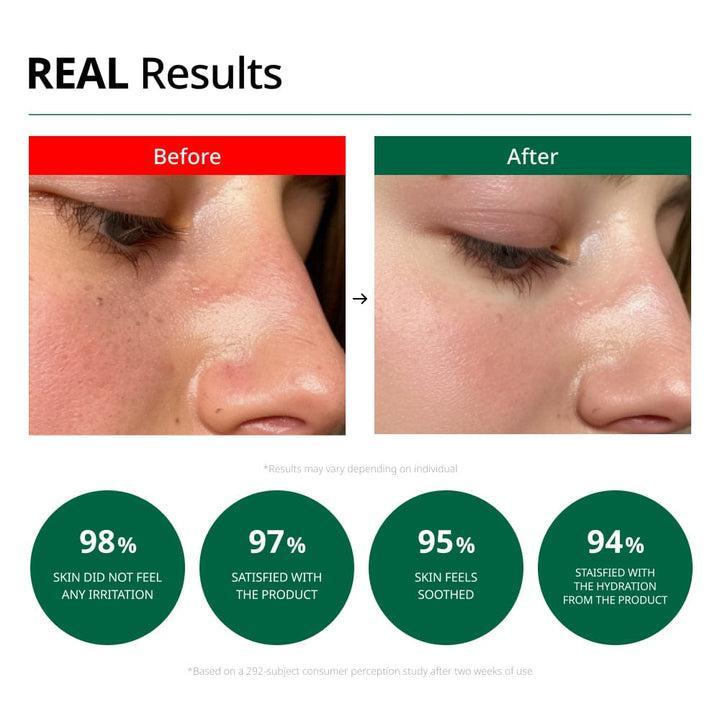 Dr.G Red Blemish Clear Soothing Cream 70ml