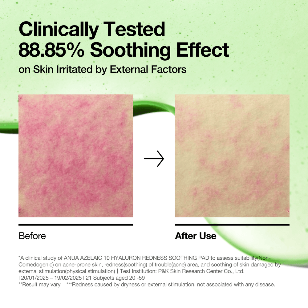 Anua Azelaic 10 Hyaluron Redness Soothing Pad 230ml 90ea